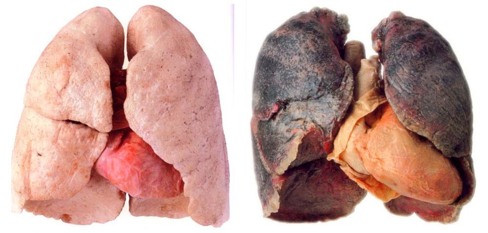 Hidden things that cause damage to the “LUNGS”