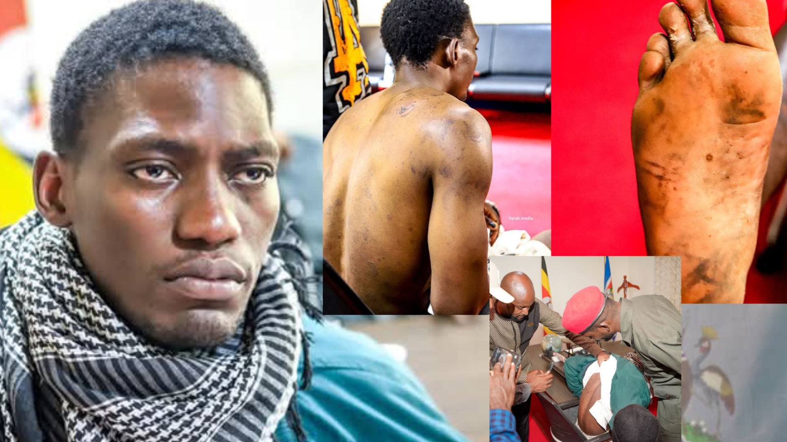 Ssebudde Kassim Who Was Abducted With Eddie Mutwe Dumped After Severe Torture – Bobi Wine