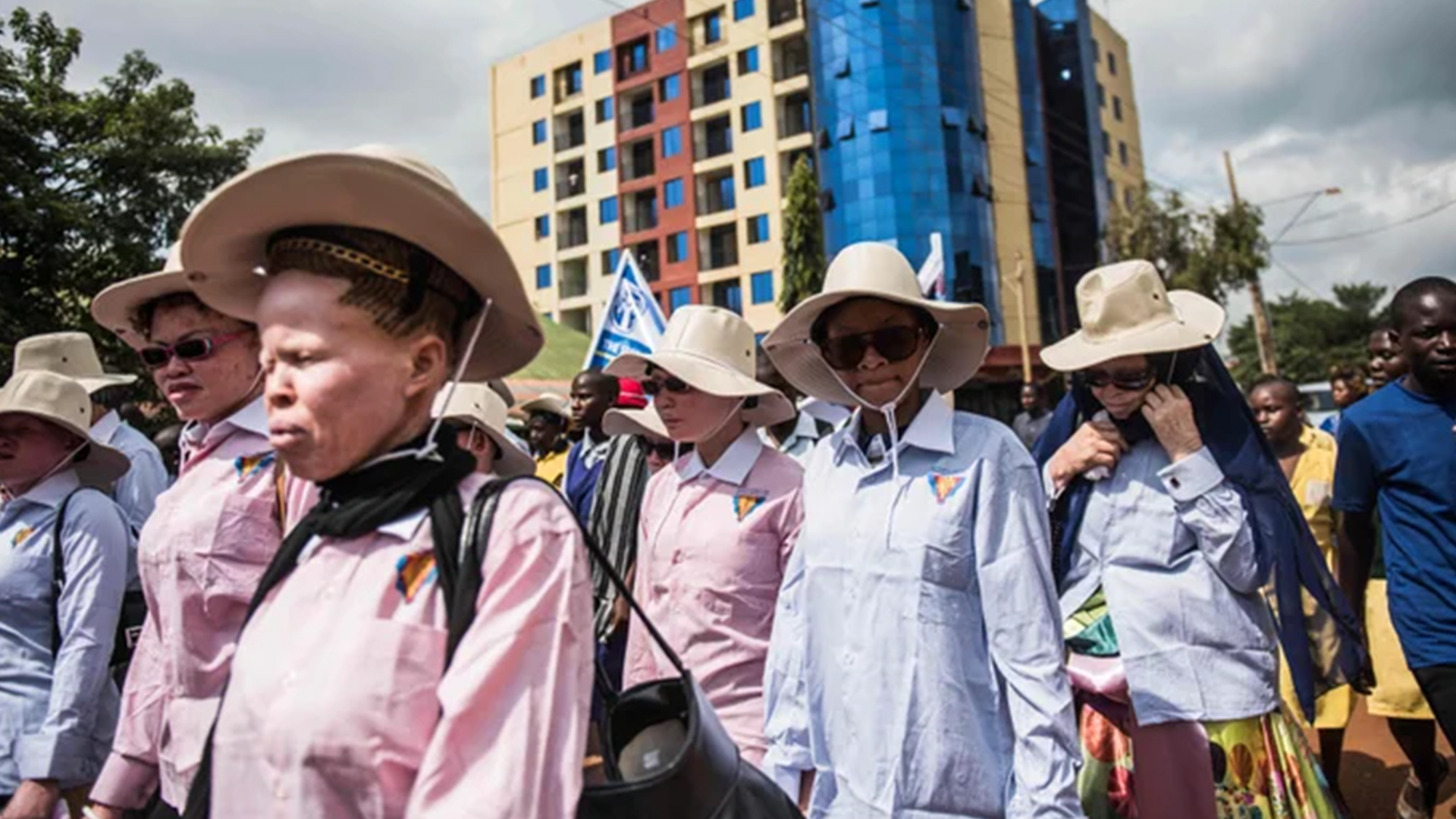 Gov’t Pushes For Equal Rights, Health Access For Persons With Albinism